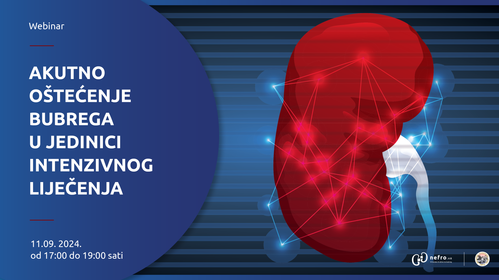 AKUTNO OŠTEĆENJE BUBREGA U JEDINICI INTENZIVNOG LIJEČENJA